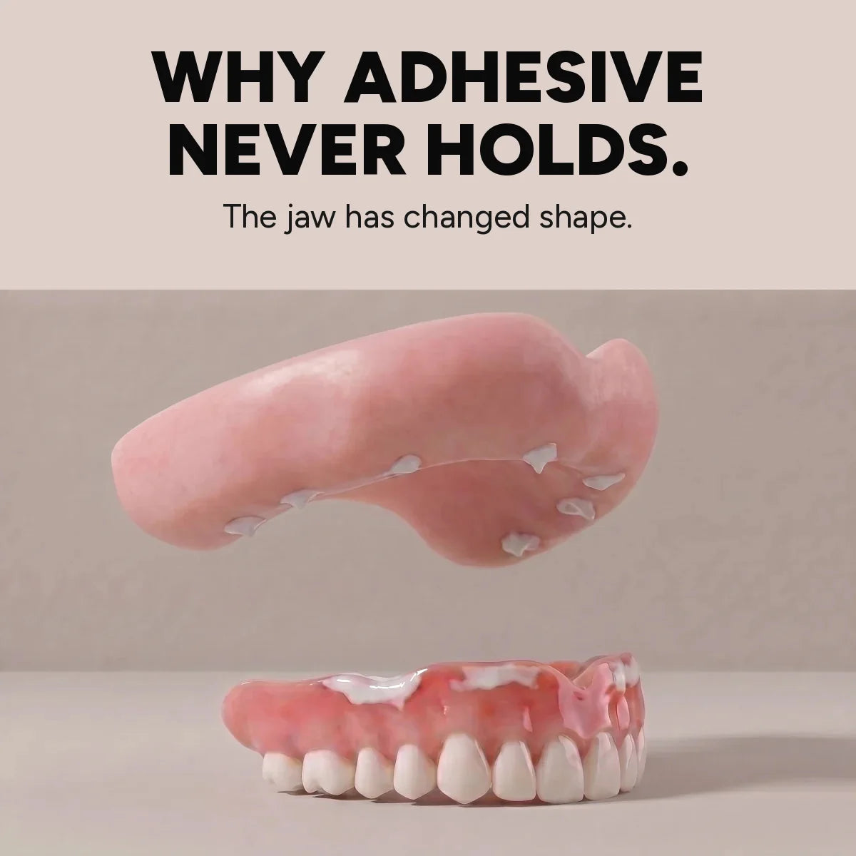 A denture no longer sits flush because the jaw has changed shape, leaving a gap underneath